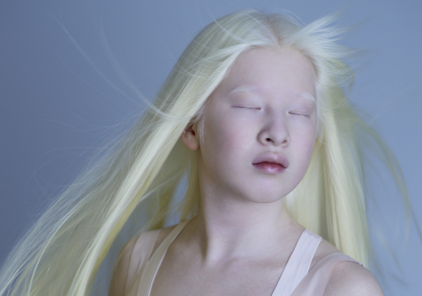 albino hair